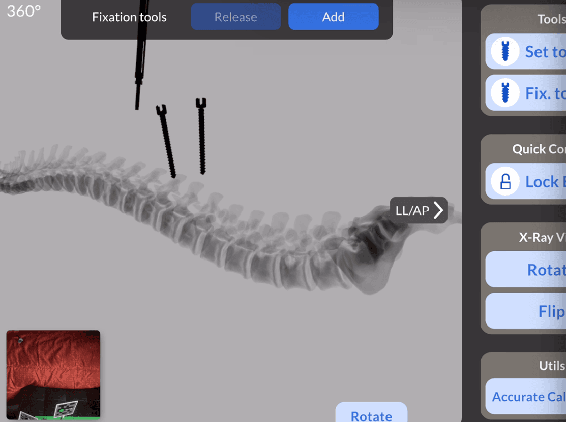 Mobile X-ray interface with rotated thoracolumbar view