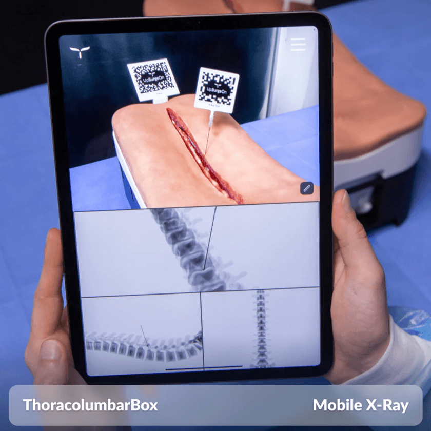 Mobile X-ray application running on a tablet with simulator and three views