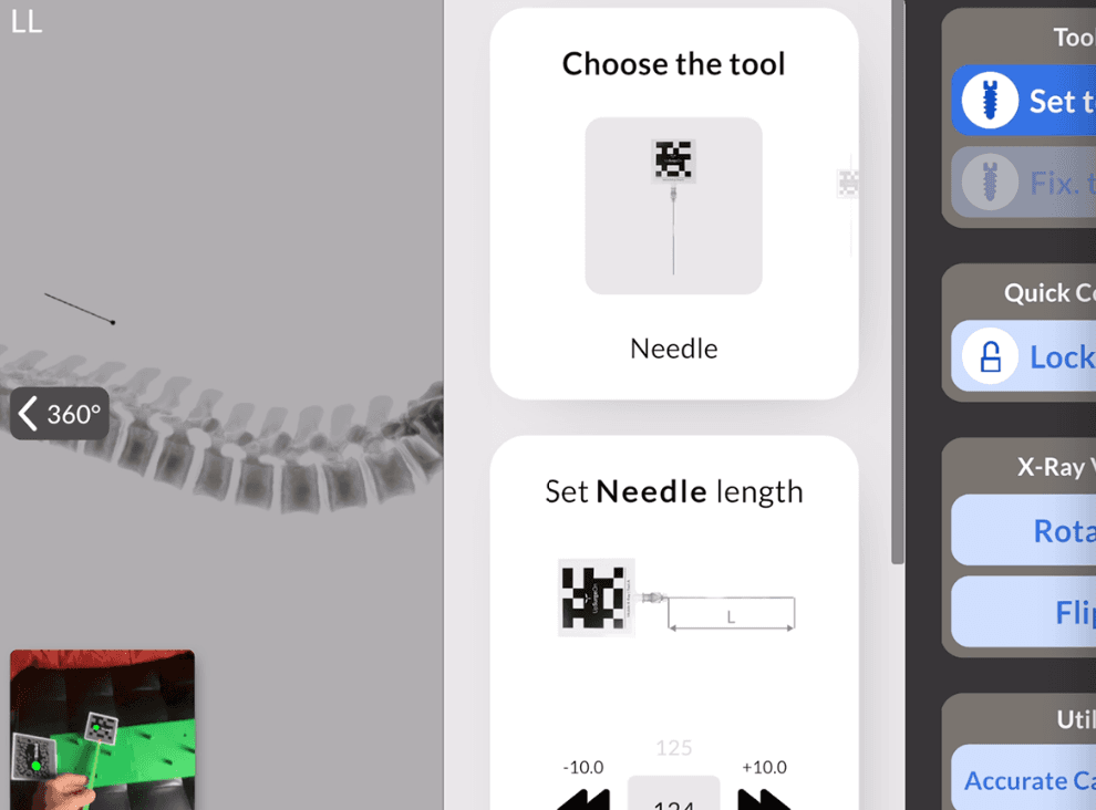 Mobile X-ray interface with a needle and lateral spine view
