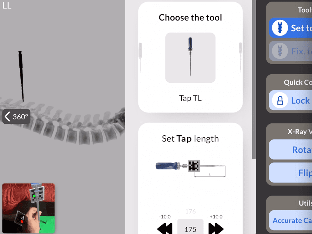 Mobile X-ray interface with a thoracolumbar tap selected