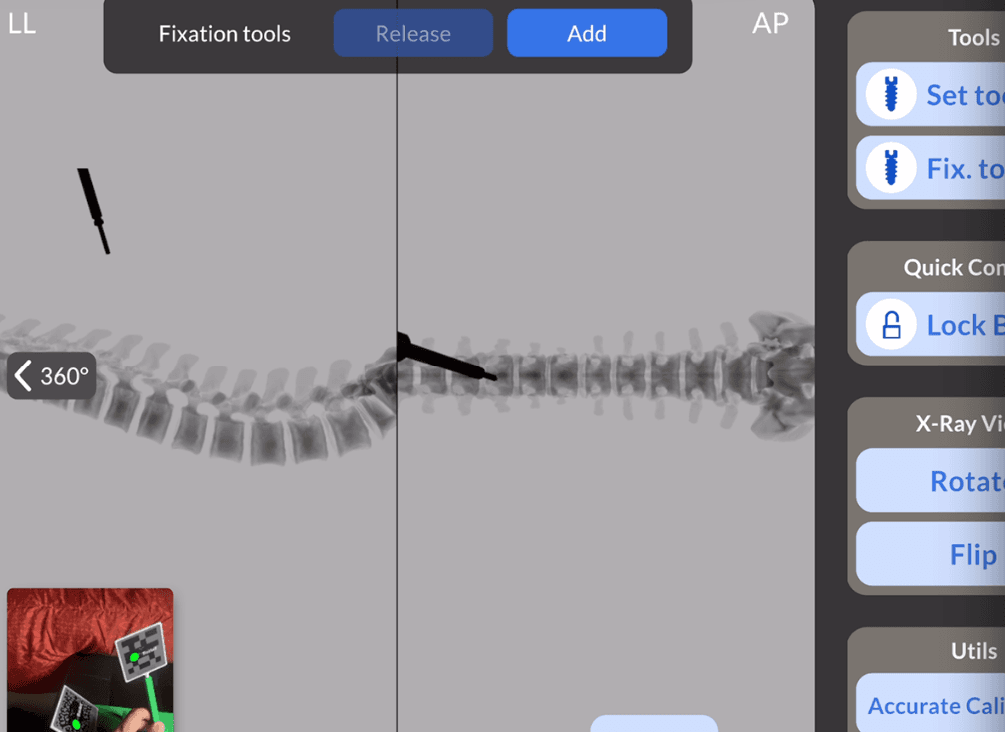Mobile X-ray simulator and top-view composition
