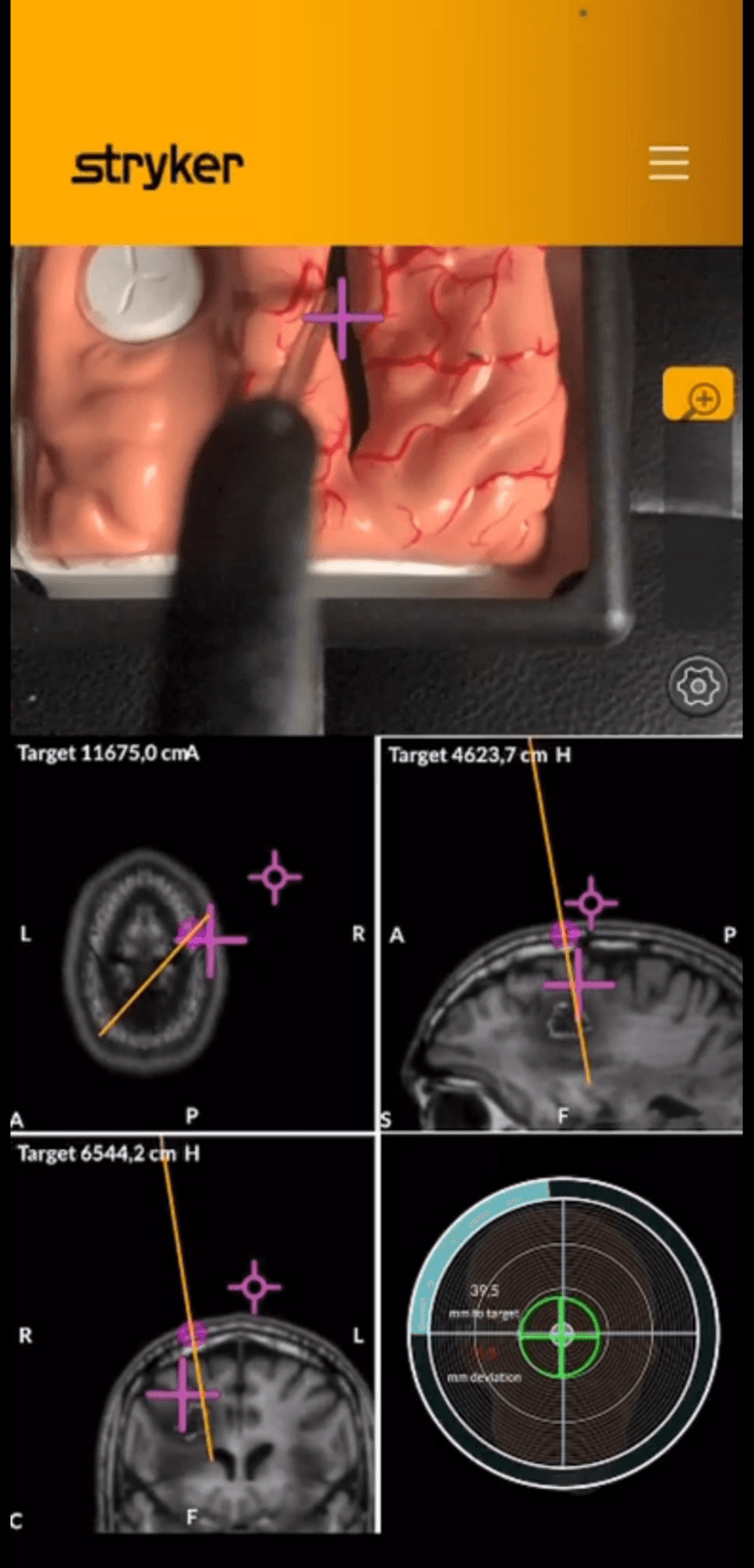 AR view with axial, sagittal and coronal image planes plus targeting guidance
