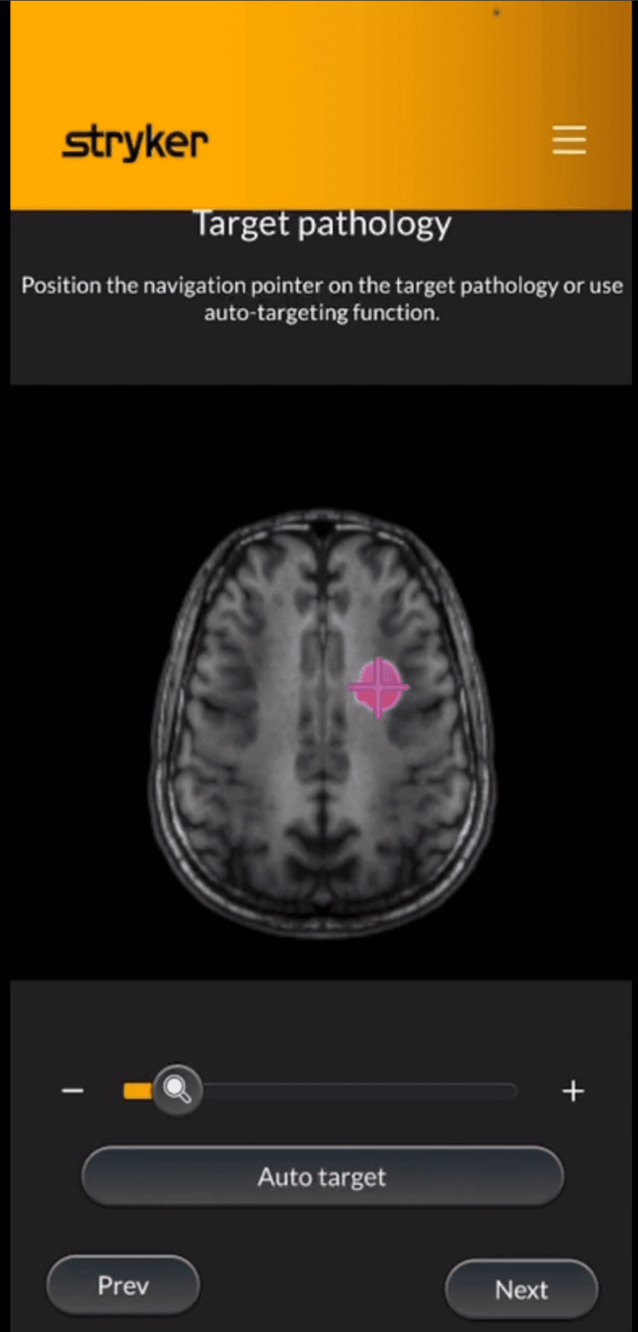 Target location interface on an axial tomographic view
