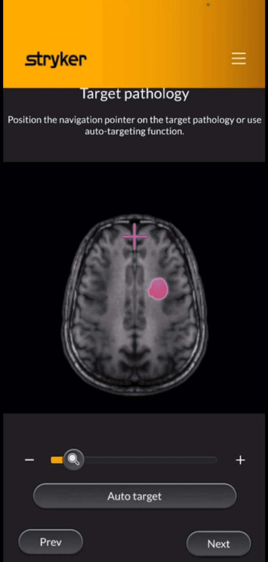 Entry point and target location shown on an axial tomographic view