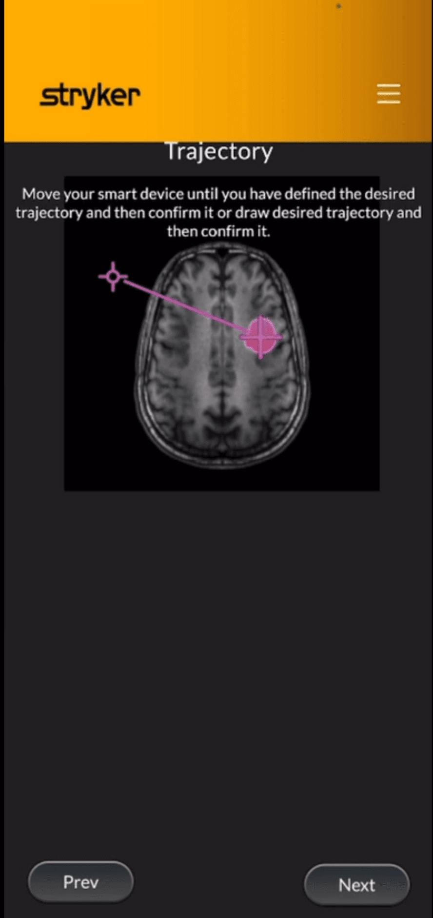 Planned trajectory between entry point and target location