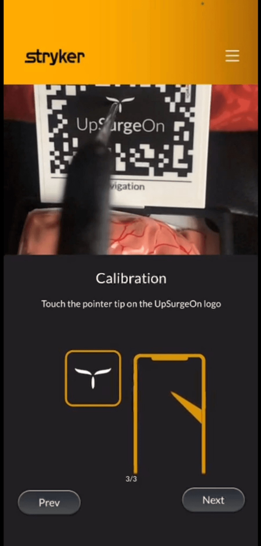 Navigation Pen calibration interface using an UpSurgeOn marker