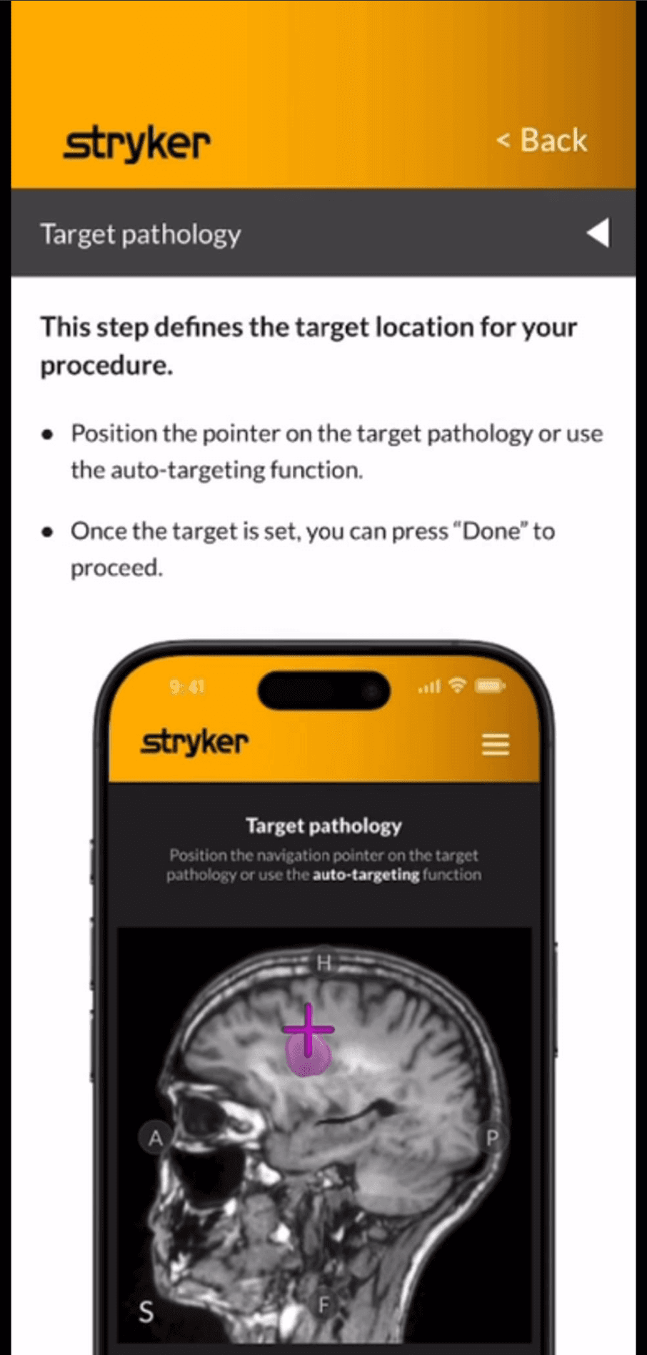 Mobile navigation guide showing target pathology selection